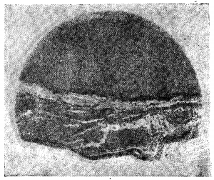 Анатомия вен спинного мозга - 47.png