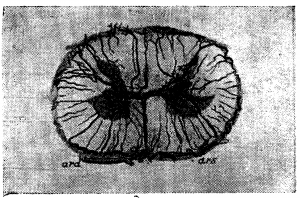 Анатомия вен спинного мозга - 02.png