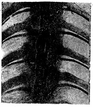 Анатомия вен спинного мозга - 04.png