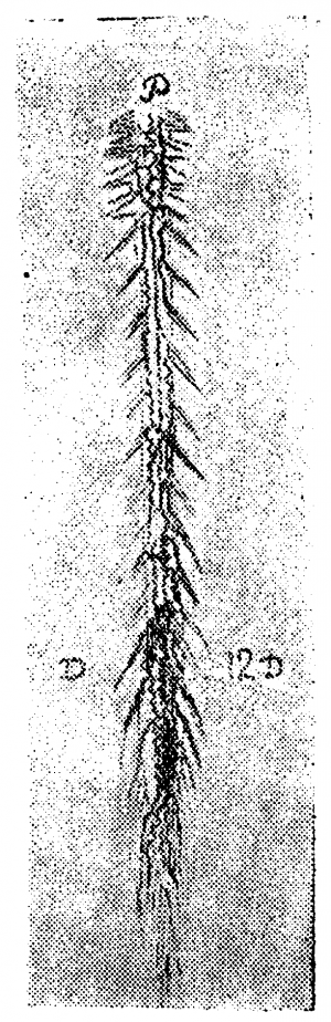 Анатомия вен спинного мозга - 54.png