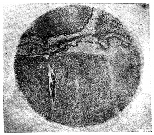 Анатомия вен спинного мозга - 52.png