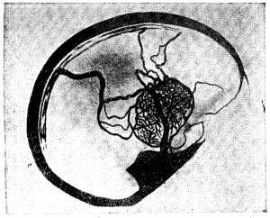 Анатомия вен спинного мозга - 34.png