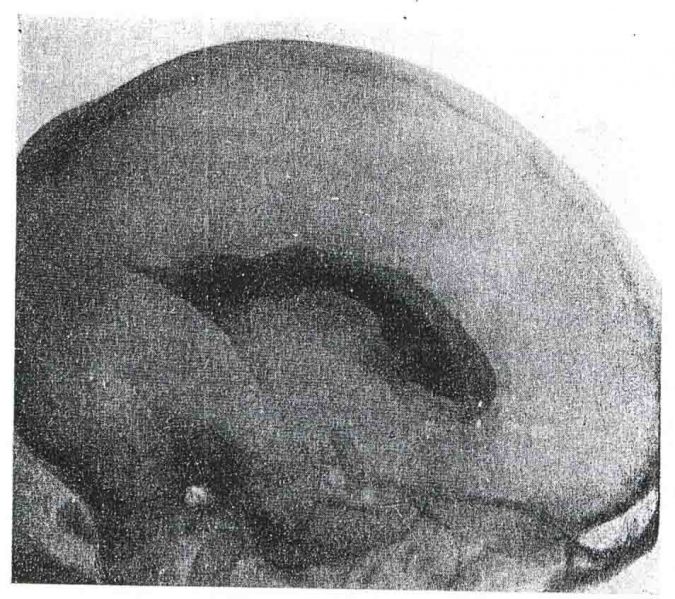 Файл:Таблица III. Рис. 4.jpg