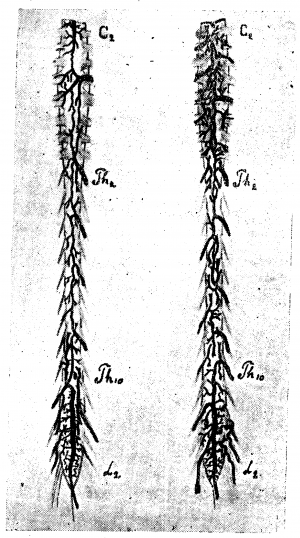 Анатомия вен спинного мозга - 17.png